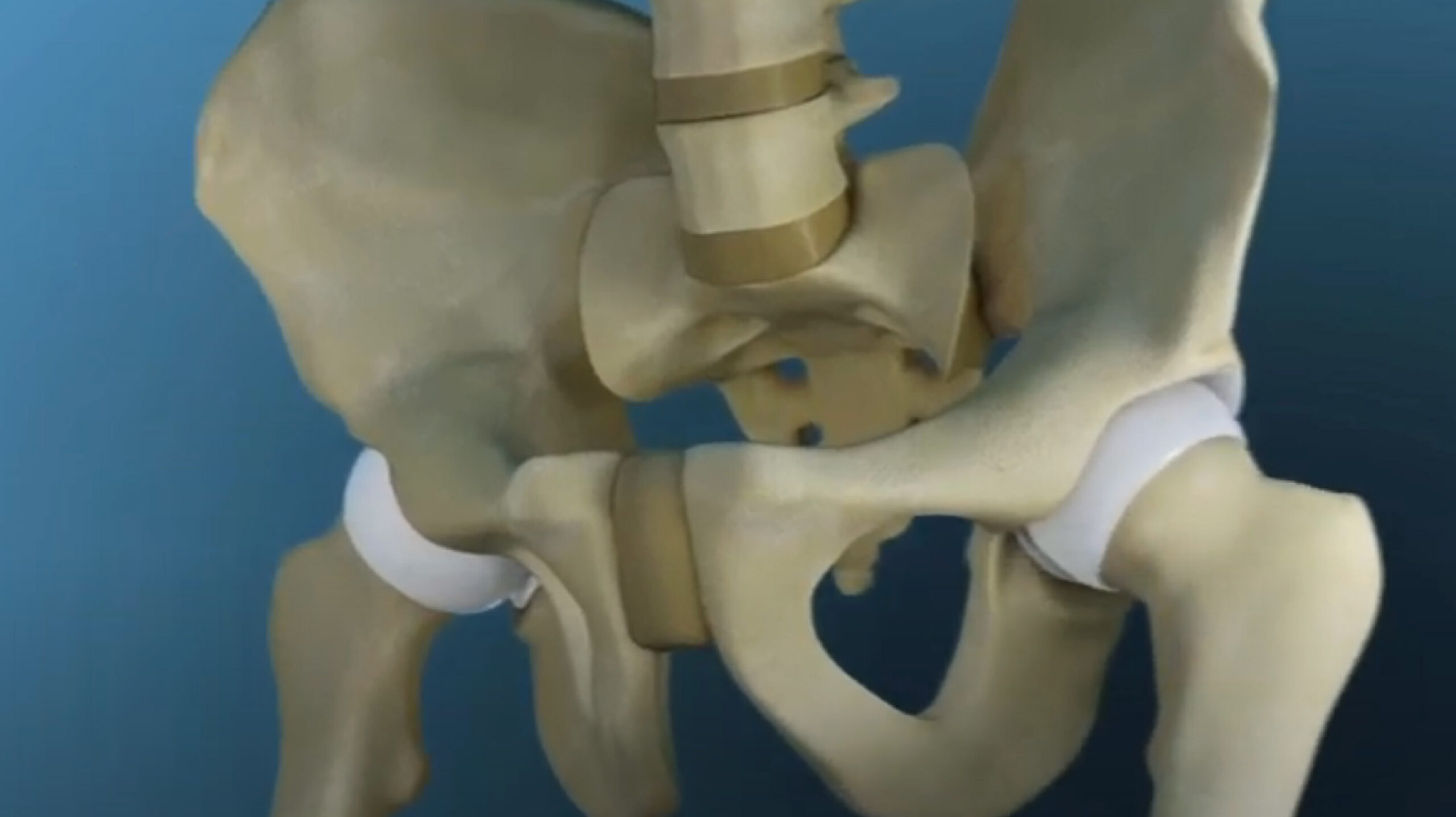 Anterior Minimally Invasive Hip Surgery